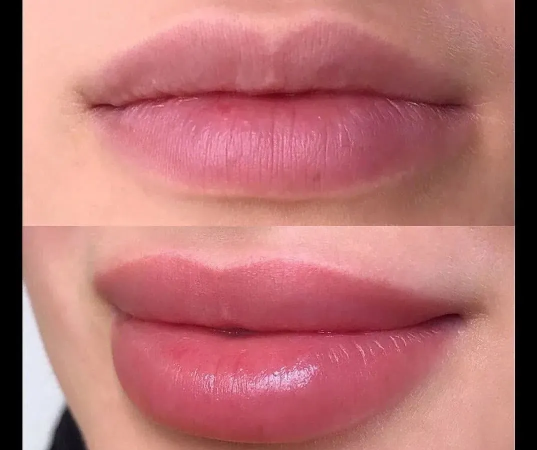 Our lip blushing program teaches you to enhance natural lip color and shape. This result shows the vibrant, fuller look you can achieve for your clients, mastering the art of permanent lip tattooing.