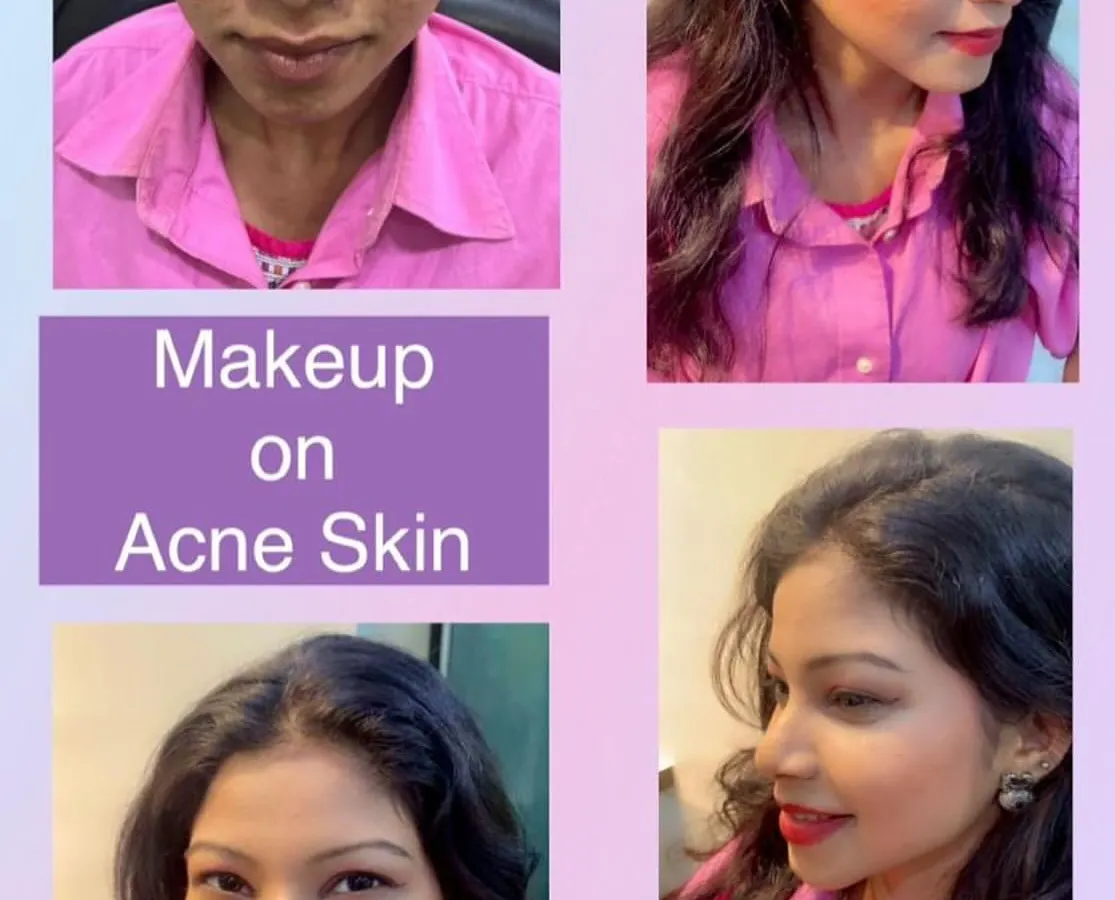 Creating a flawless finish on acne-prone skin is one of our specialties. Here, you can see how we achieved a smooth, even base that looks natural and feels lightweight. We use specific techniques to provide coverage without irritating the skin, helping you feel confident for your event.