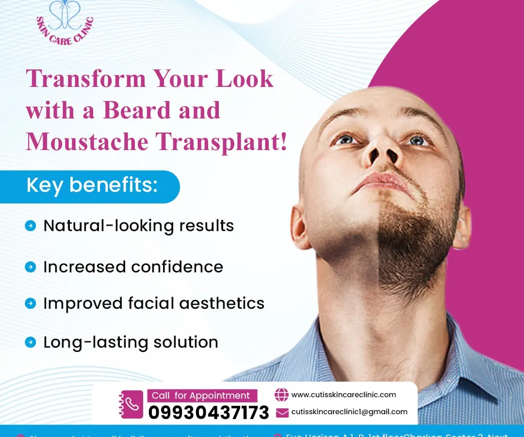 This split-view image showcases the transformative power of a beard and moustache transplant. One side shows a face with patchy, sparse facial hair, while the other reveals a full, dense, and well-defined beard, highlighting the natural-looking results we achieve.