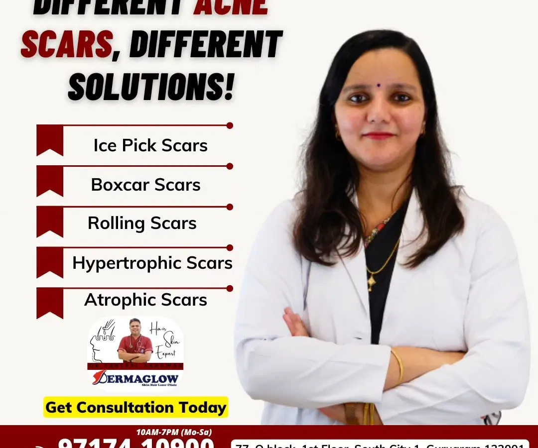 I understand that not all acne scars are the same. This graphic outlines the different types of scars we treat, including ice pick, boxcar, rolling, hypertrophic, and atrophic scars. My approach is to first identify your specific scar type to create a targeted and effective treatment plan.