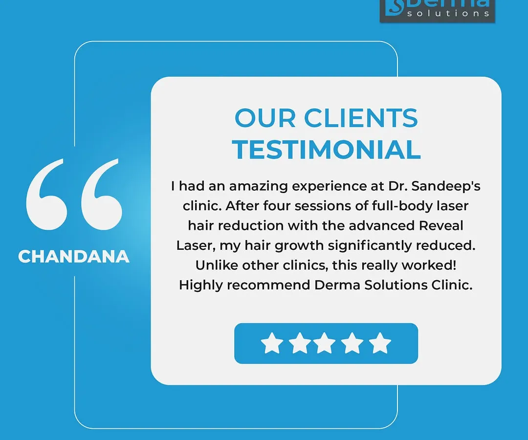 We are proud to share feedback from our clients. This testimonial highlights the significant reduction in hair growth after just four sessions of full body laser hair reduction, showcasing the effectiveness of our advanced Reveal Laser technology.
