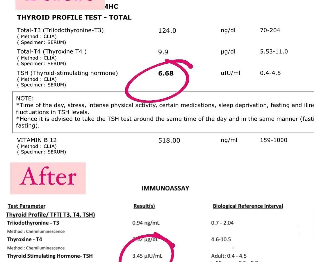 We believe in results you can see. This client's Thyroid Stimulating Hormone (TSH) level dropped from an elevated 6.68 to a healthy 3.45 in just two months on our program, demonstrating the power of functional nutrition in reversing hormonal imbalances.