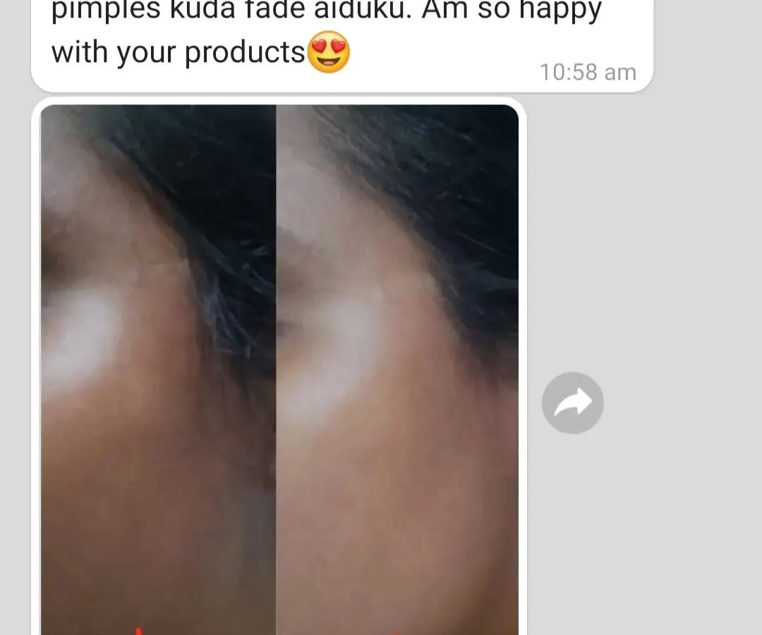 It makes me so happy to see the real difference my products make. This customer saw a visible reduction in small pimples and a wonderful glow after using the gold facial bombs. This is why I believe in natural, gentle care.