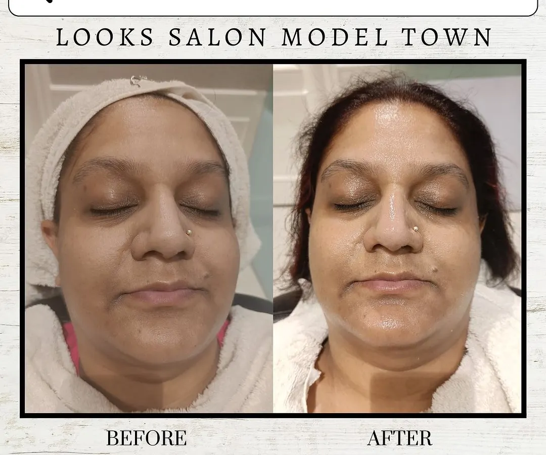 Real, visible results are what we promise. This before and after showcases the power of a single Dermalogica Age Smart Treatment, revealing brighter, smoother, and more youthful-looking skin.