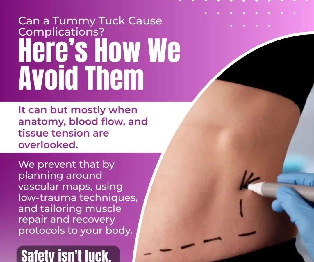 Safety is the foundation of every procedure I perform. For a tummy tuck, this means detailed planning that includes mapping your body’s vascular structures. This precision allows for a low trauma technique, which leads to a safer procedure, less bruising, and a smoother recovery.