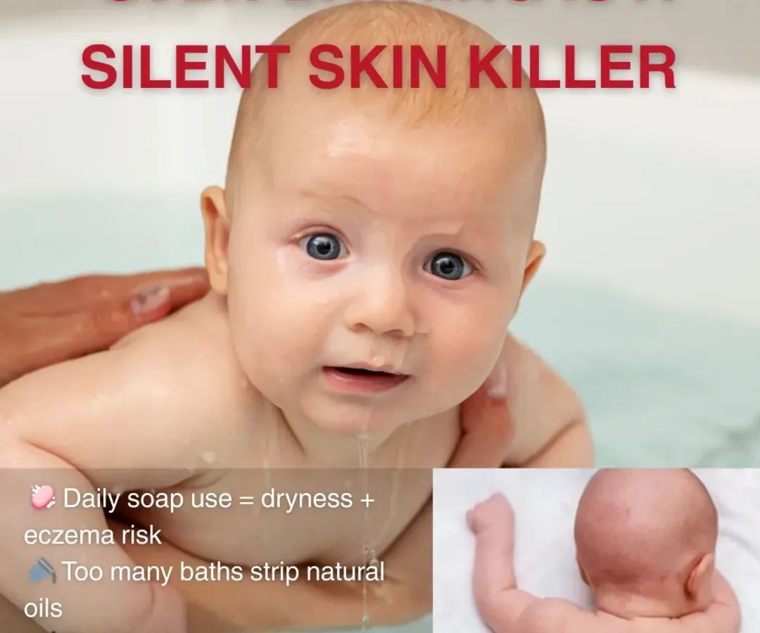 A common mistake I see parents make is over bathing their babies. An infant's skin is extremely delicate and requires a different approach than adult skin. Using the wrong products or bathing too frequently can lead to dryness, eczema, and rashes.