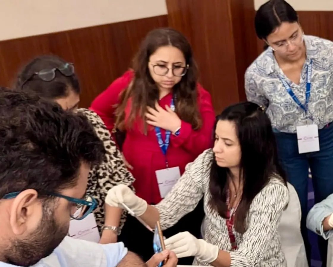Here I am demonstrating a hands-on procedural technique during a Vitiligo workshop for other dermatologists. I believe that sharing knowledge is key to advancing our field, and I am passionate about teaching the practical skills required for successful Vitiligo surgery, including suspension preparation and grafting.