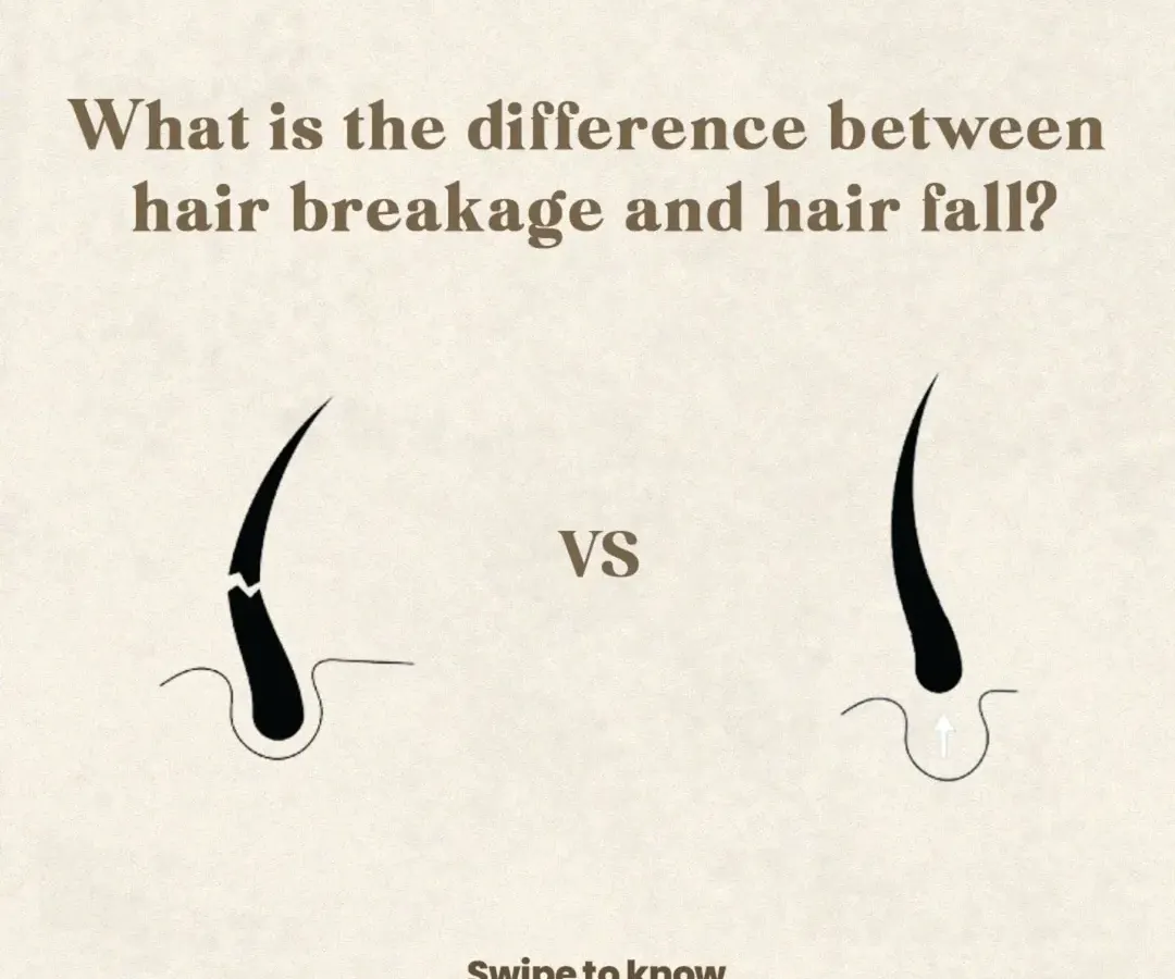 Understanding the difference between hair fall from the root and hair breakage along the shaft is the first step in a correct diagnosis. This distinction is critical as it dictates the entire course of treatment, ensuring we address the true underlying cause of your hair concern.