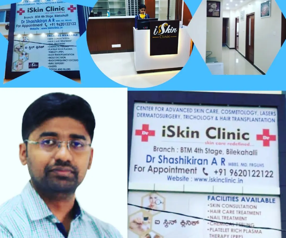 A glimpse into our professional environment at the iSkin Clinic BTM branch. This collage features our lead Dermato-trichologist Dr. Shashikiran, our modern reception area, a clean and well-lit patient corridor, and our clinic's exterior signage listing available services like hair transplantation and PRP therapy.