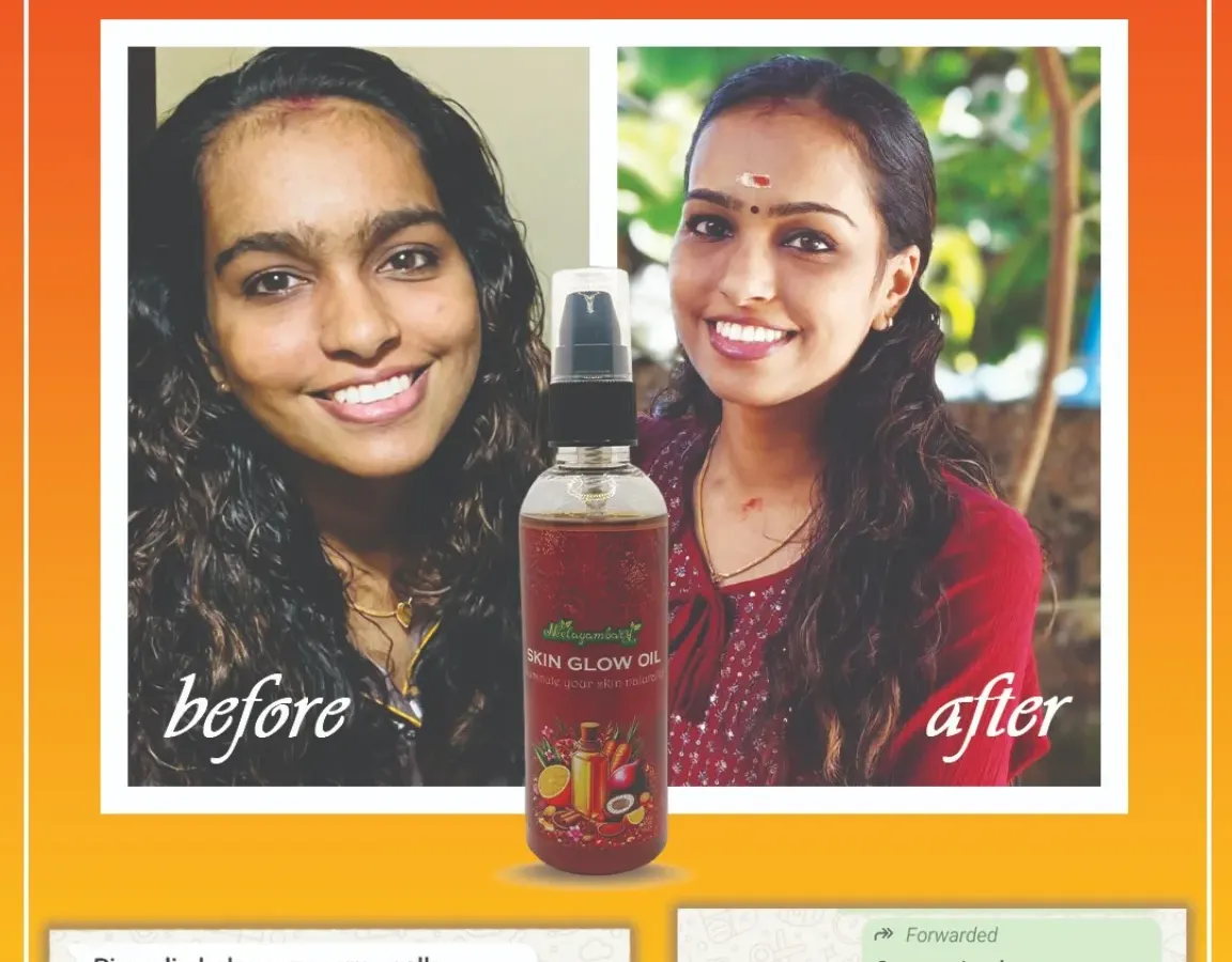 This is the result that makes all my hard work worth it. You can see how our Ayurvedic Skin Glow Oil helped reduce scars and pimples, bringing out a natural, healthy glow. Seeing this kind of happiness in my customers is my biggest reward.