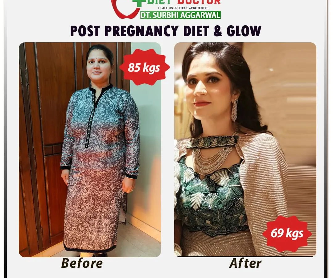 This client's post-pregnancy transformation is a testament to what's possible with the right nutrition. We focused on a diet that supported her recovery and provided energy, helping her lose 16 kgs and regain her pre-pregnancy glow and confidence.
