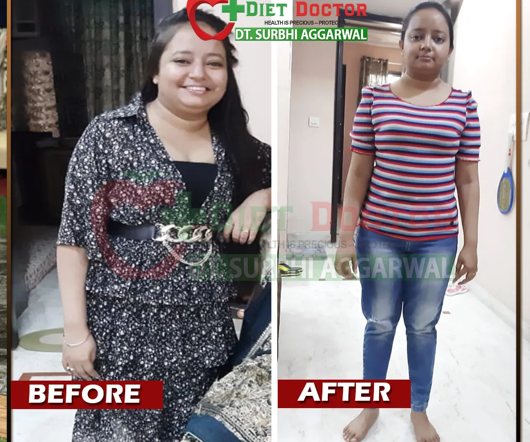 This before and after image shows the powerful transformation of Akansha, a chartered accountant who lost 7 kgs in 3 months. Despite a hectic schedule and health challenges like high blood pressure, she achieved significant weight loss and improved her health markers.