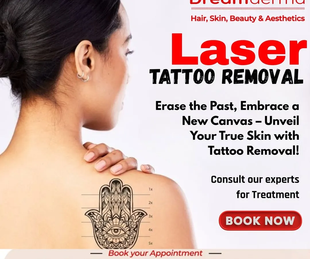 Ready for a new beginning? My laser tattoo removal service helps you erase unwanted ink and gives you a fresh canvas. It is a safe and effective way to reclaim your skin and embrace a new you.