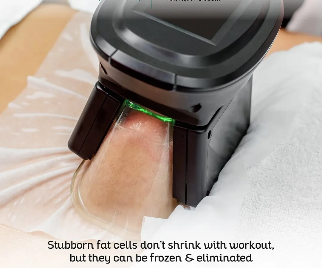 Some fat is resistant to diet and exercise. Our Cryolipolysis treatment uses science to solve this by freezing and eliminating stubborn fat cells permanently and safely, without any surgery.