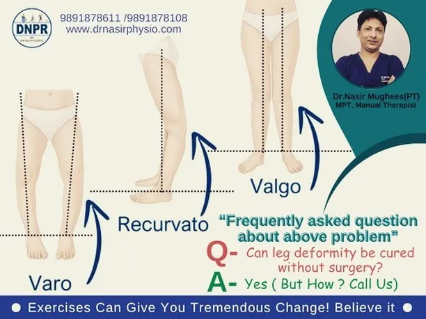 Are you worried about knock knees or bow legs showing up in your medical exam? I want you to know that you don't have to go for surgery. With the right physiotherapy exercises and manual therapy, we can correct these leg deformities and improve your alignment for defence, police, or paramilitary selection.