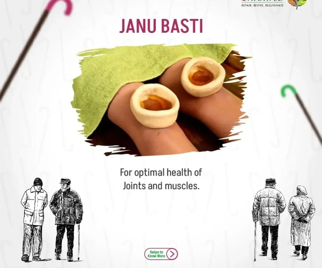 This is Janu Basti, a cornerstone of our knee pain treatment. A reservoir made of dough is placed on the knee and filled with warm, medicated oil. This specialized therapy lubricates the joint, nourishes the surrounding tissues, and provides significant relief from the pain and stiffness associated with osteoarthritis.