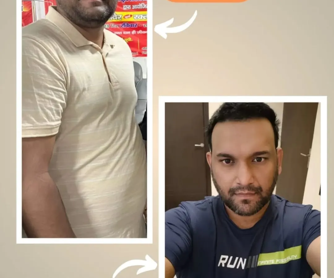 This is what sustainable change looks like. This transformation was achieved in just 3 months through a personalized diet plan focusing on fat loss, not just weight loss, using everyday kitchen ingredients.