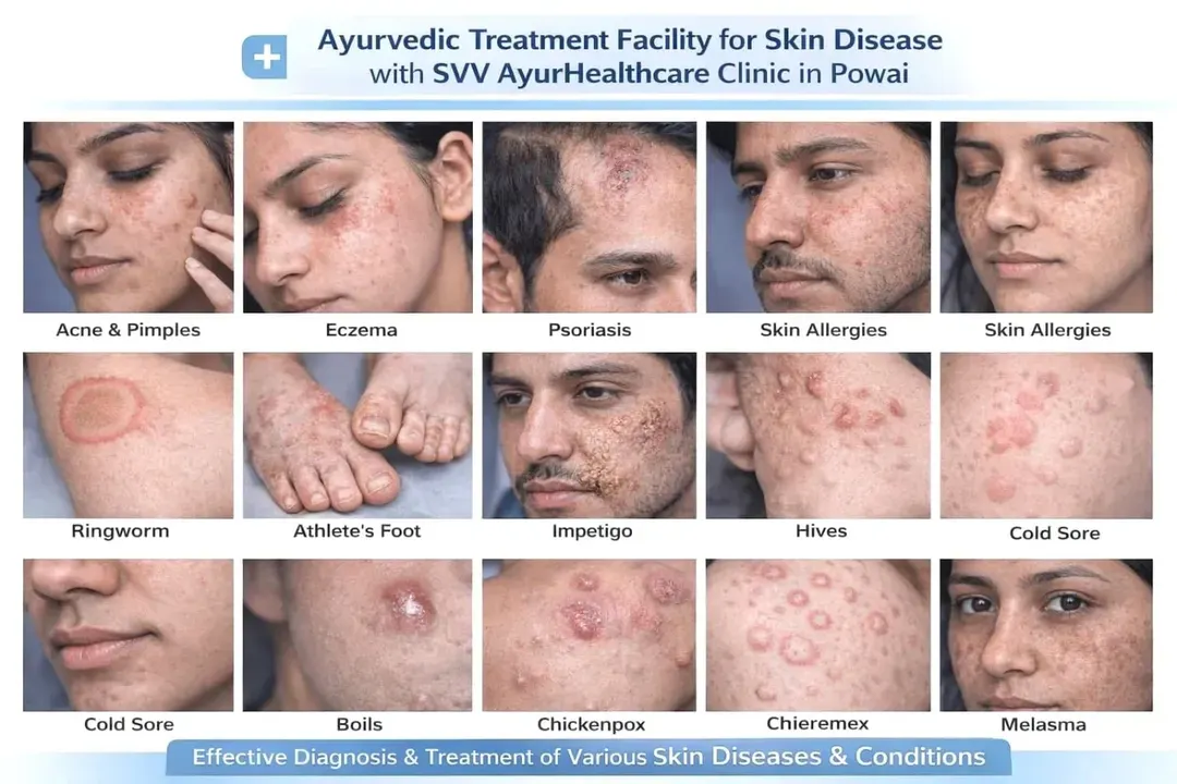 I treat a wide spectrum of skin diseases at my clinic. This collage shows some of the common conditions I can help you with, including acne, eczema, psoriasis, ringworm, and pigmentation issues like melasma. My goal is to provide an effective diagnosis and lasting treatment for your specific concern.