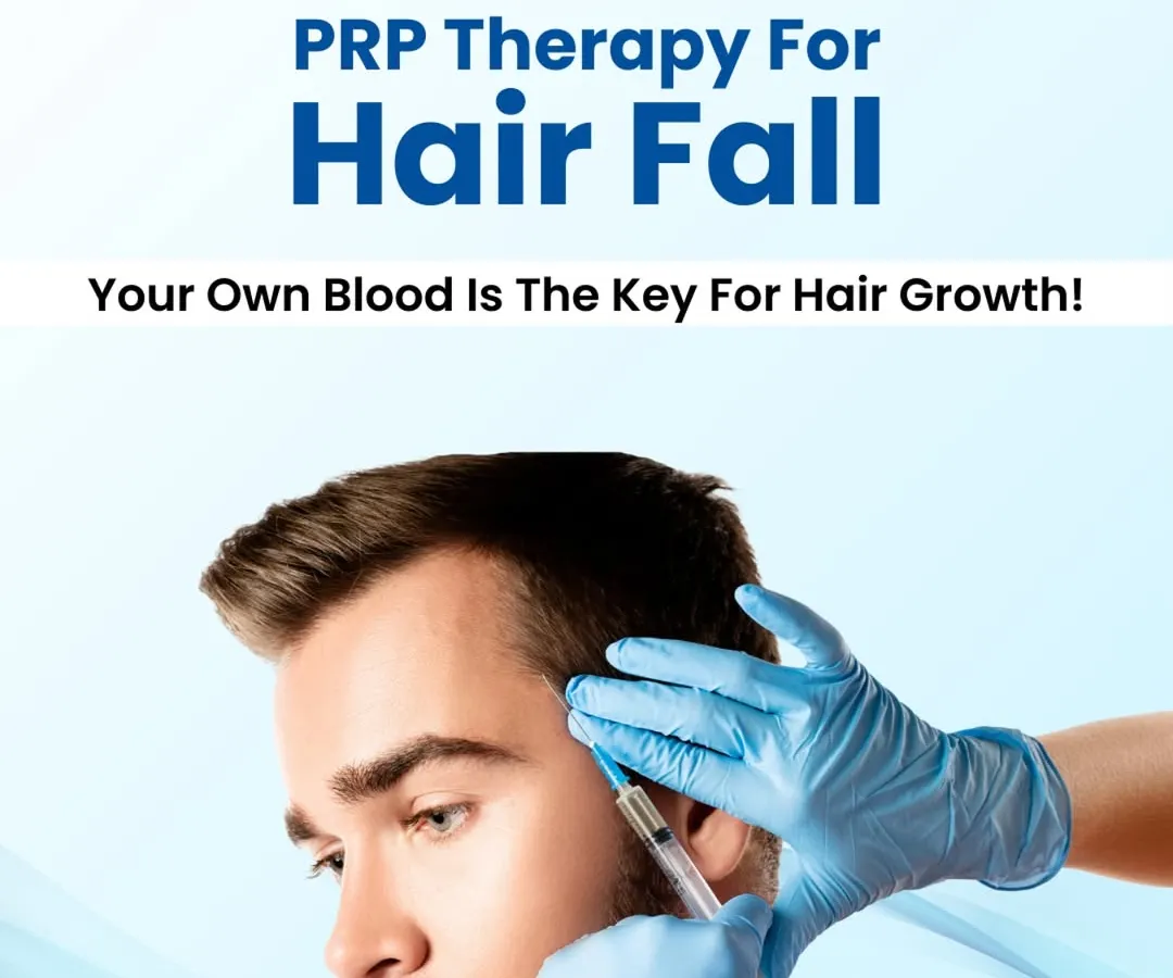 I often recommend Platelet-Rich Plasma or PRP therapy as a natural and effective solution for hair fall. This treatment uses the healing power of your own blood to stimulate dormant hair follicles, strengthen roots, and encourage new, healthy hair growth. It is a safe procedure performed in a clinical setting to ensure the best results.
