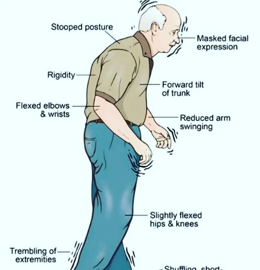 My therapeutic yoga practice offers specific support for neurological conditions like Parkinson's disease. This infographic shows the typical physical challenges, and my sessions focus on re-establishing the mind-body connection to improve posture, reduce rigidity, and enhance overall mobility.