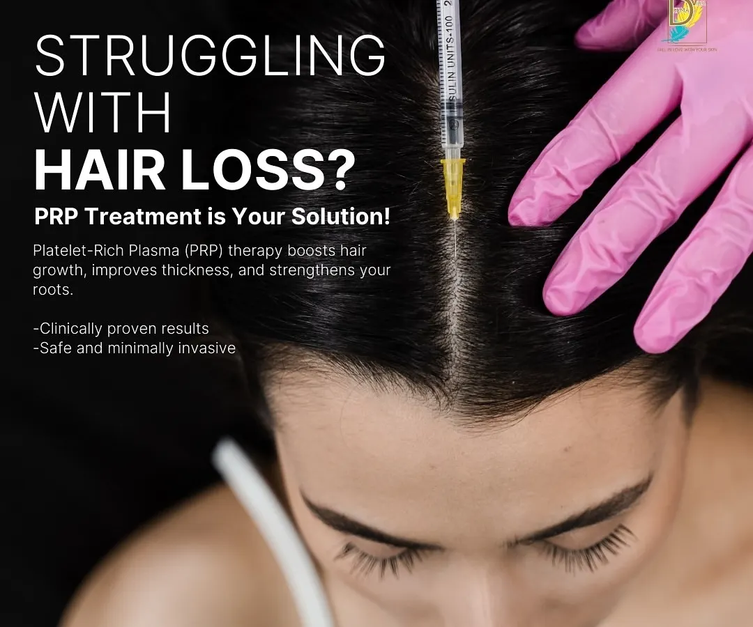Here you can see a Platelet-Rich Plasma (PRP) treatment in progress. This procedure uses the healing power of your own blood to boost natural hair growth and improve thickness. It is a safe, minimally invasive, and clinically proven solution for tackling hair loss at the root.