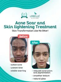 Advanced Skin & Facial Treatments