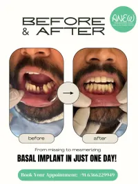 Cosmetic Dentistry