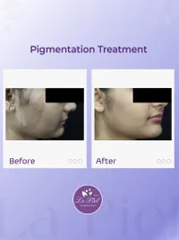 Advanced Skin Rejuvenation & Glow Treatments