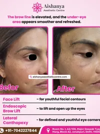 Facial Cosmetic Surgery