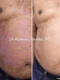 Medical Dermatology (Skin & Hair Conditions)