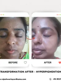 Ayurvedic Skin & Hair Treatments