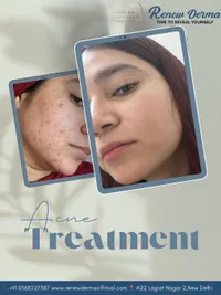 Advanced Skin Treatments