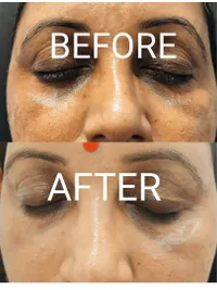 Advanced Facials & Skin Rejuvenation