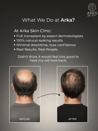 Hair Restoration & Scalp Treatments