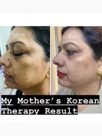 Advanced Skincare Treatments