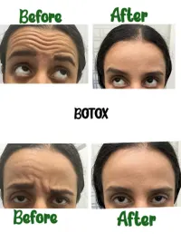 Injectables & Facial Contouring