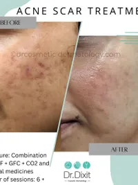 Skin Brightening & Pigmentation Correction