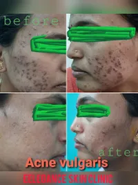 Aesthetic Dermatology
