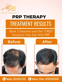 Hair Fall & Regrowth Treatment