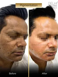 Skin Correction & Rejuvenation