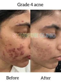 Medical-Grade Facials & Peels