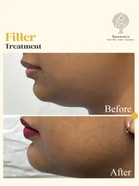 Facial Aesthetics & Anti-Aging