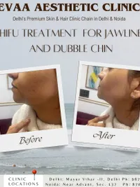 Skin Tightening & Non-Surgical Lifts