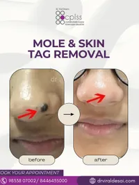 Skin Rejuvenation & Brightening