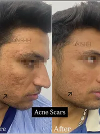Advanced Skincare Treatments