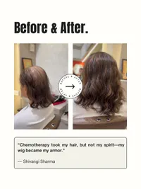 Hair Loss Solutions (Wigs & Toppers)