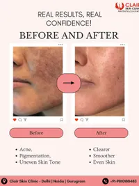 Advanced Facials & Peels