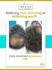 Hair Restoration & Laser Hair Removal