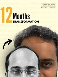 Hair Restoration & Treatment