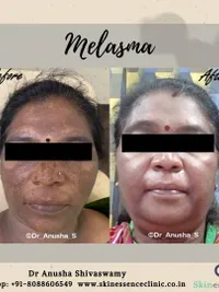 Cosmetic & Anti-Aging Treatments